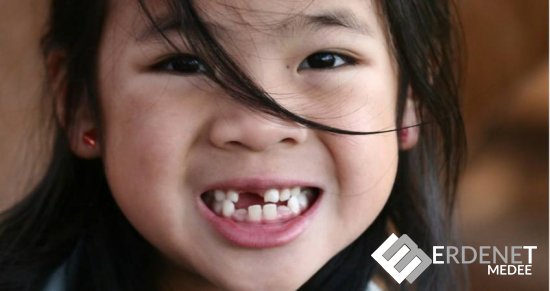 Хүүхдийн шүдийг хэрхэн хамгаалах вэ