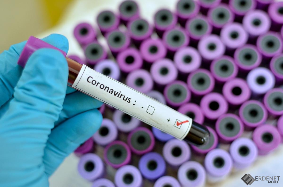 Австрали: Коронавирусын вакцин гарган авсан хоёр дахь улс боллоо